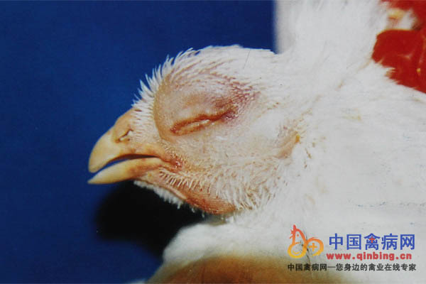 肉种鸡发生禽流感（H5N1亚型），面部皮下胶冻肿胀