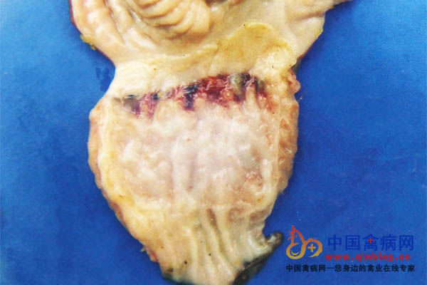 病死鸡腺胃与肌胃交界处有条状出血斑